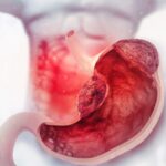 Facteurs de risque cancer de l'estomac