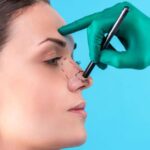 rhinoplastie