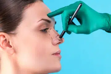 rhinoplastie