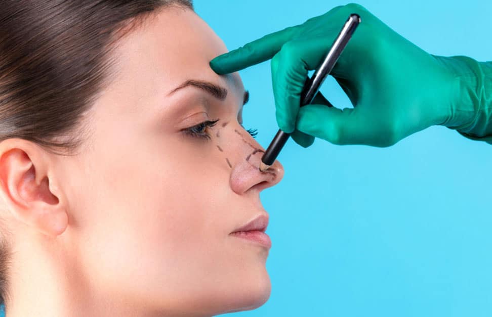 rhinoplastie