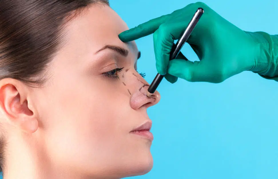 rhinoplastie